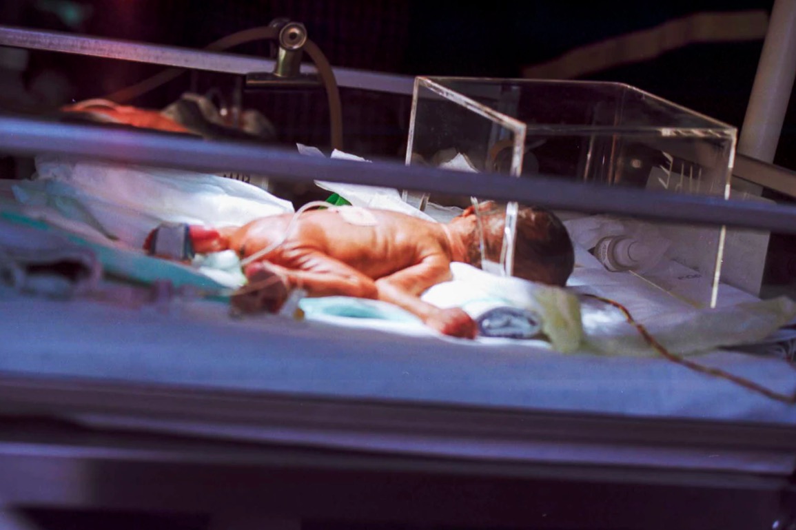 La couveuse, l'oxygénation, et le bébé prématuré