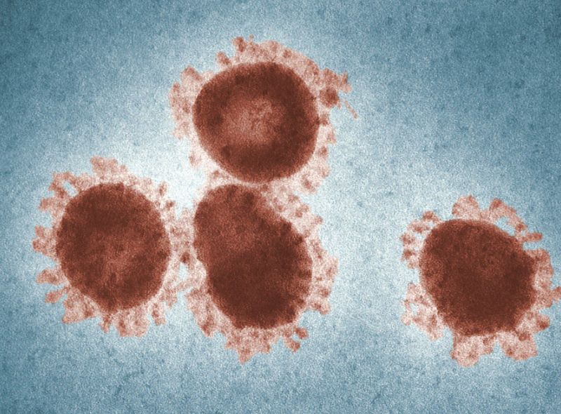 Virus au miroscope covid 19