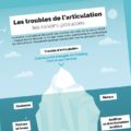 Les troubles de l’articulation